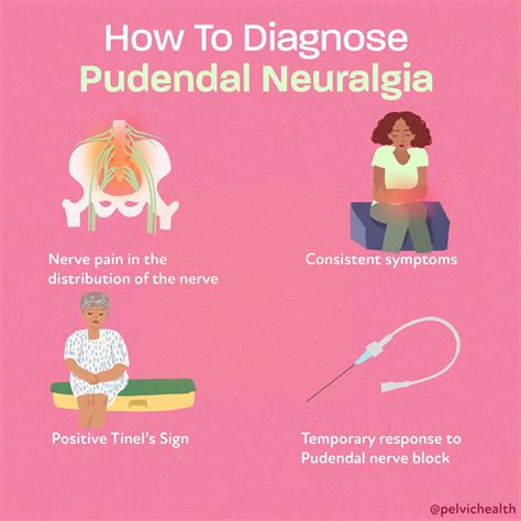 Pelvic Floor Nerve Damage Symptoms | Viewfloor.co