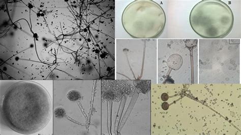 Phylum Ascomycota Overview - Biology Notes Online