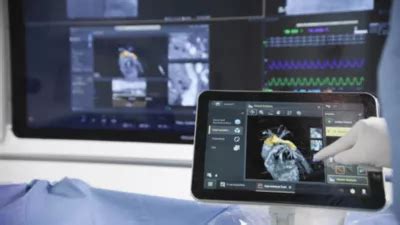 Philips - SmartCT Angio - Advanced 3D visualization - Philips