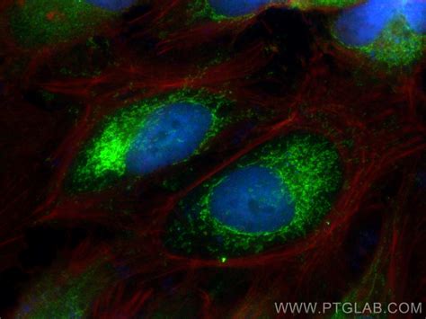 SOD2 antibody (24127-1-AP) | Proteintech