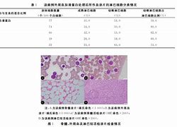 Image result for CLL 慢性淋巴细胞性白血病
