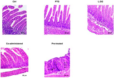 Lactobacillus rhamnosus GG Protects the Epithelial Barrier of Wistar ...