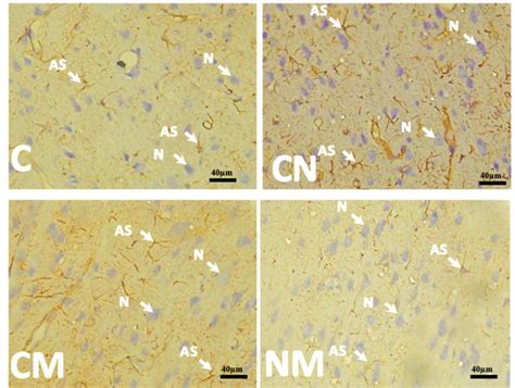 Image result for Prefrontal Cortex Mouse Brain