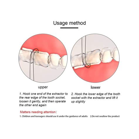 Buy RZJZGZ 5 Pack Clear Aligner Removal Tool for Invisible Brace Tooth ...