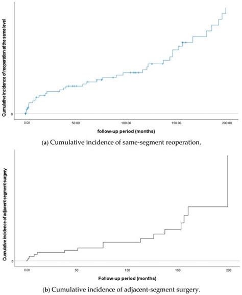 Coflex Interspinous Stabilization with Decompression for Lumbar Spinal ...