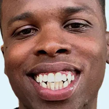 Why Choose Invisalign® Over Other Aligners | Invisalign.com