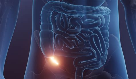 Image result for Appendicitis