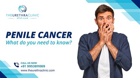 Penile Cancer Early Signs