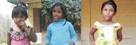 Fluoride Contamination Cripples a Thousand Children in Assam - The Wire