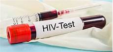 test per l hiv aids vicina con farmaci anti hiv lo studio test per l hiv aids vicina con farmaci anti hiv lo studio