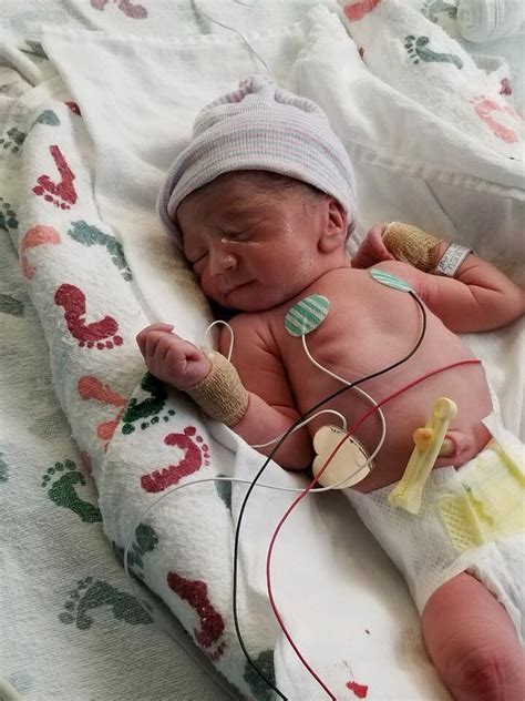 Baby Born At 34 Weeks - Baby Viewer