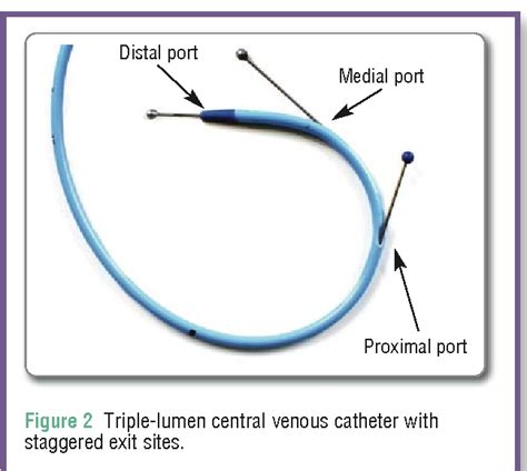 Image result for CVC Line Distal Port