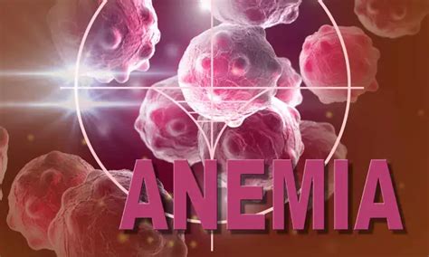 Anemia Predicts Adverse Outcomes in High-Risk PCI Patients with Impella ...