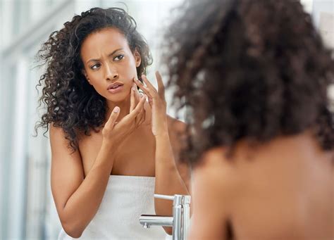 How to Prevent, Buffer, and Heal Retinol Skin Burns | RealSelf News