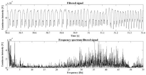 A Real Time Feed Forward Control of Slug Flow in Microchannels
