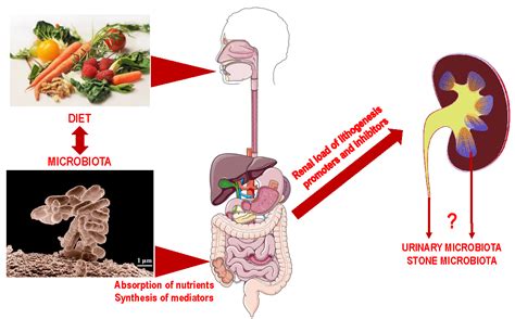 Calcium Oxalate Nephrolithiasis and Gut Microbiota: Not just a Gut ...