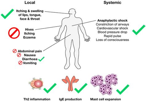 Mouse Models for Food Allergies: Where Do We Stand?