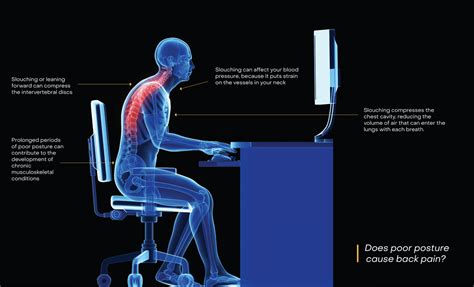 Poor Ergonomics Posture Delve Into The Detrimental Effects Of