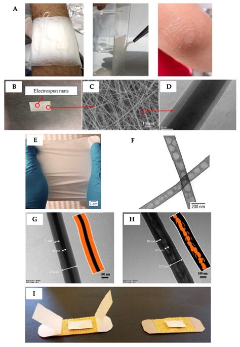 Developments of Core/Shell Chitosan-Based Nanofibers by Electrospinning ...