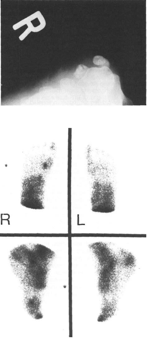 Understanding Hida Scan Results
