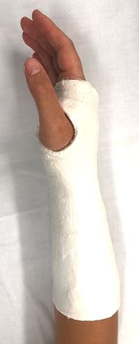 Hand Plaster 的图像结果