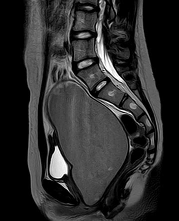 Image | Radiopaedia.org