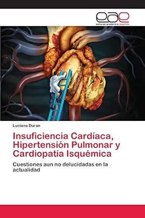 Buy Insuficiencia Cardíaca, Hipertensión Pulmonar y Cardiopatía ...