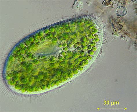 Kingdom Protista: Euglenoids, Slime Moulds and Protozoans - Biology ...