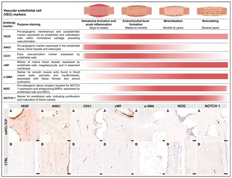 Histological and Immunohistochemical Characterization of ...