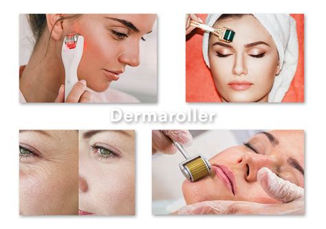 Dermaroller Treatment in Chennai || Dr. Lavanya Skin & Hair Clinic