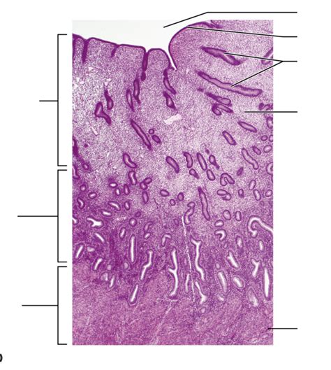 Image result for Endometrium Functional Layer