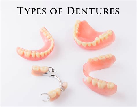 Dentures Belfast - dentist in Dundonald Belfast