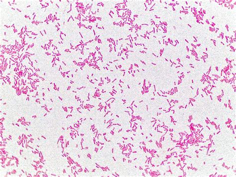 Rod Bacteria Under Microscope at Sherri Pineiro blog