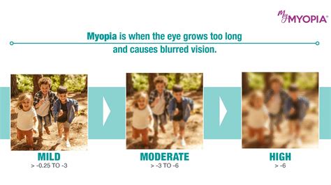 Myopia Treatment for Children in Chicago | Eye Society
