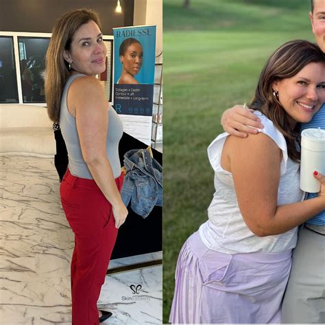 Semaglutide & Tirzepatide Injections for Weight Loss - Skin Esteem Med Spa