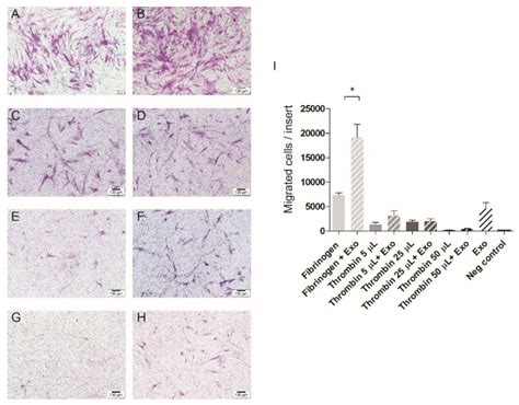 Pulp-Derived Exosomes in a Fibrin-Based Regenerative Root Filling Material