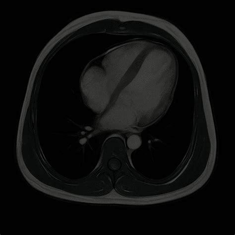 Heart Disease Risk Detection & Full Body Scan | Cent AI