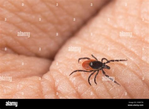 Image result for Embedded Deer Tick