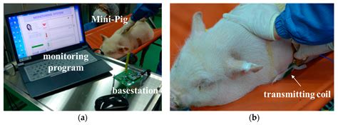 Development of ECG Monitoring System and Implantable Device with ...