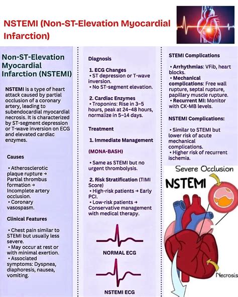 Understanding NSTEMI: A Type of Heart Attack | Maha Adel posted on the topic | LinkedIn
