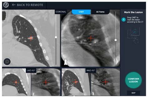 Learning Curve of Real-Time Imaging with C-Arm Based Tomography for ...