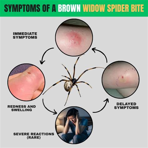 Brown Widow Spider Bite: Symptoms, Treatment, and Safety Tips