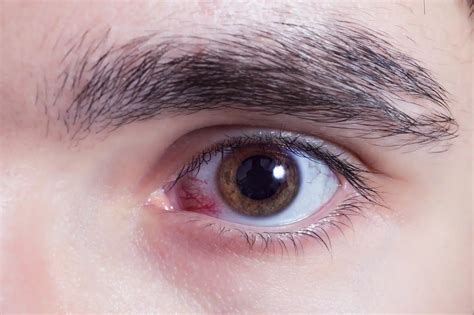 Dilated Pupils Drugs: Drugs That Cause Pupils to Dilate