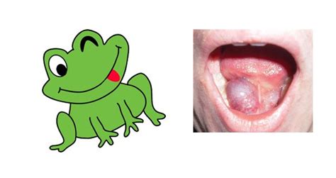 Dental Topics - Dental Edge