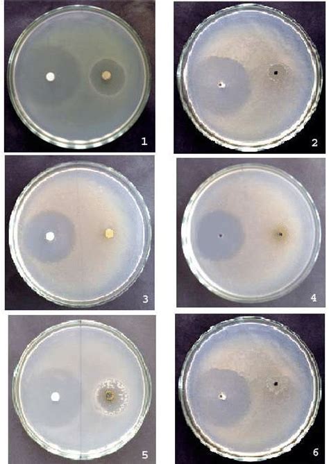 Agar Disc Diffusion Method 的图像结果