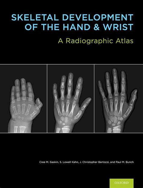 Skeletal Development of the Hand and Wrist: A Radiographic Atlas and ...