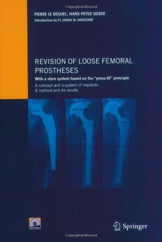 Revision of loose femoral prostheses with a stem system based on the ...