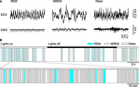 Rem Sleep Eeg Pattern at Christopher Lewis blog