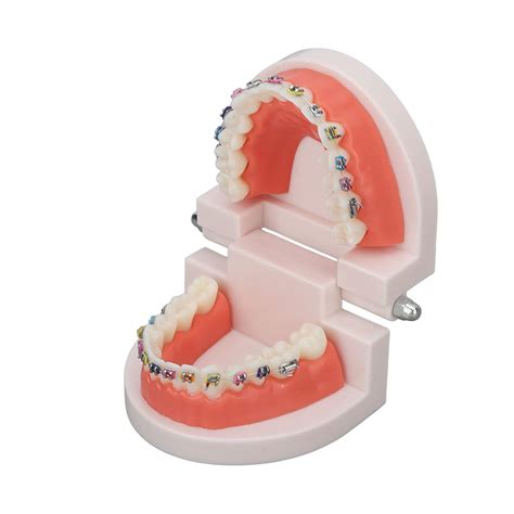 Orthodontic Teeth Model, with Buccal Tube Brackets Orthodontic ...