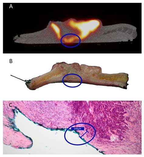 High-Resolution 18F-FDG PET/CT for Assessing Three-Dimensional ...